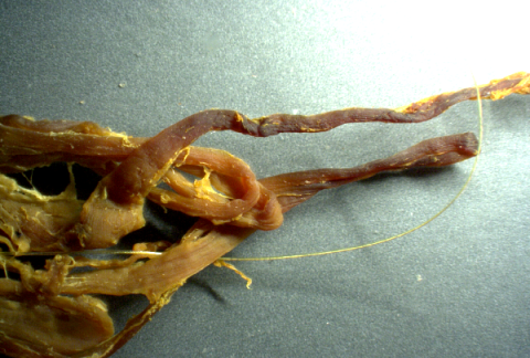 Jane Ruby ismerteti a beoltott holttestekben talált önszerveződő 