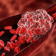 SZÖVET SZERVEZŐDÉS PROFIT: A Medicare tavaly több mint 15 milliárd dollárt költött vérhígítókra a covid oltások szövetszerveződései miatt