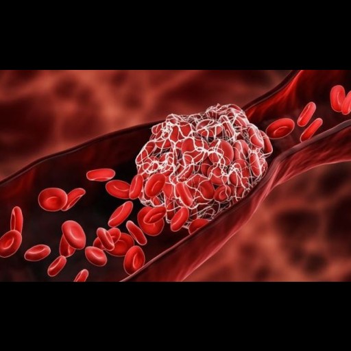 SZÖVET SZERVEZŐDÉS PROFIT: A Medicare tavaly több mint 15 milliárd dollárt költött vérhígítókra a covid oltások szövetszerveződései miatt